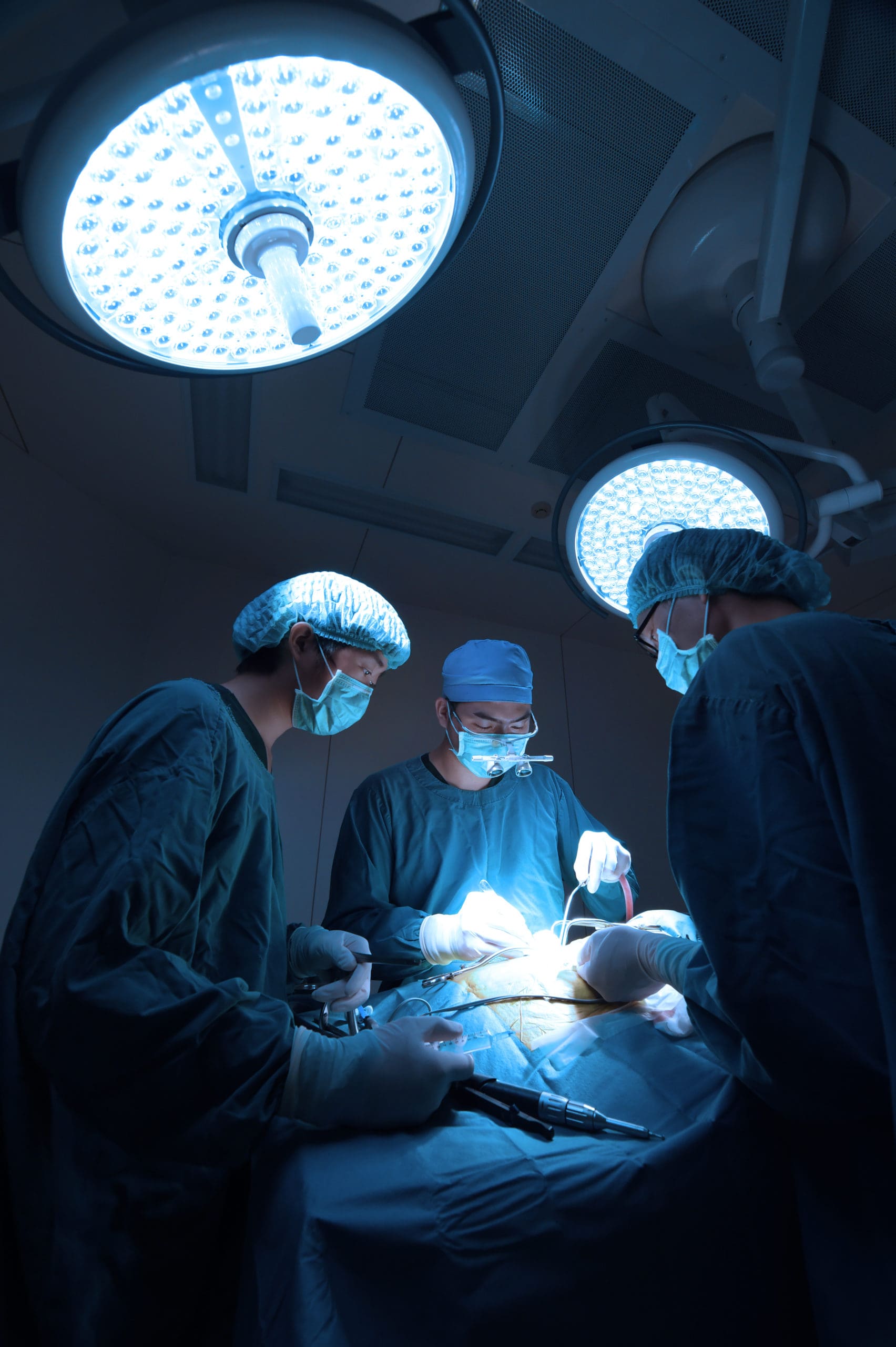 China segmentation surgical devices