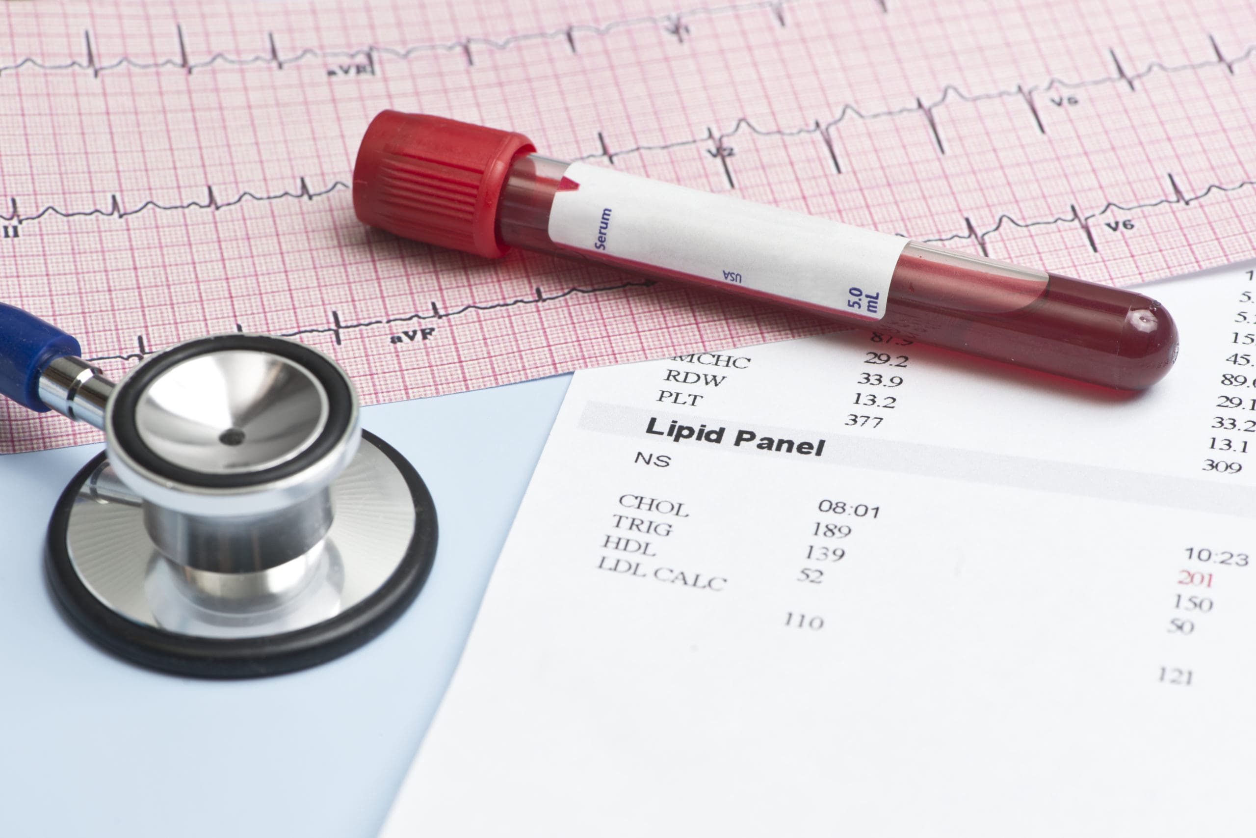 Cardiac biomarker testing market outlook in Asia-Pacific