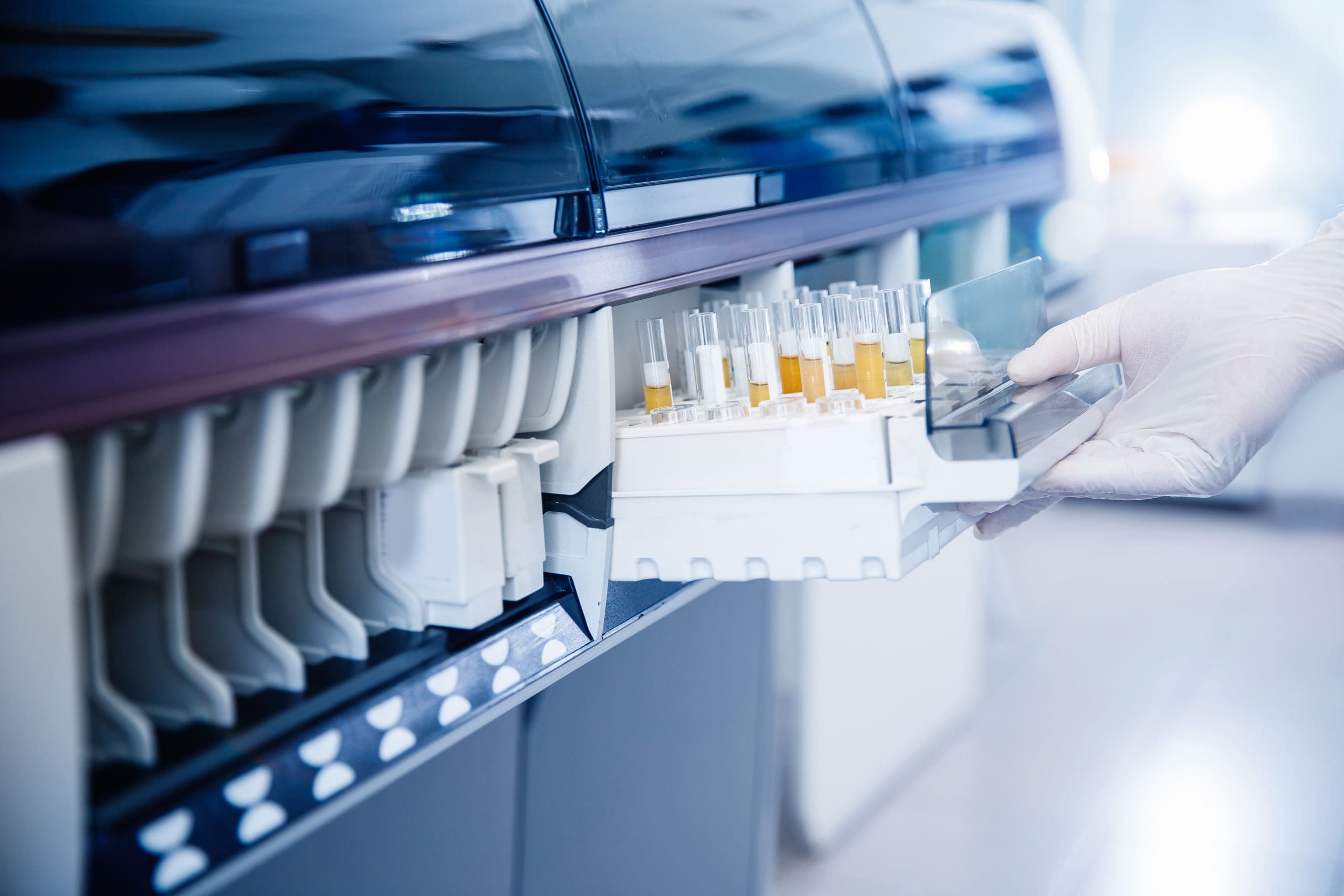The future of point-of-care cardiac biomarker testing