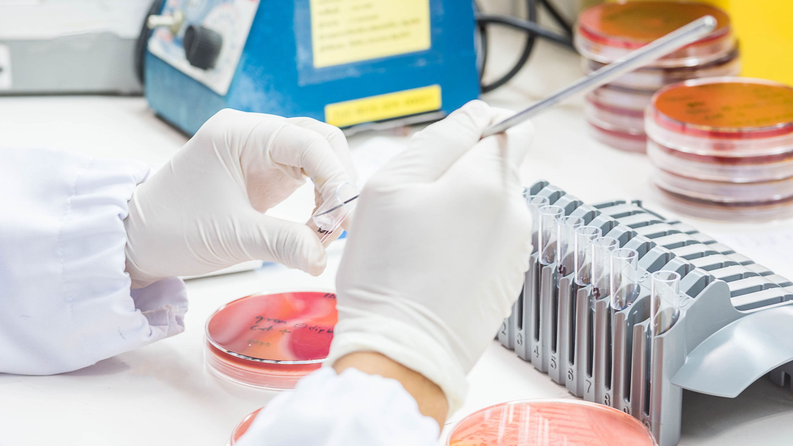 Infectious Diseases Trend Monitor: India